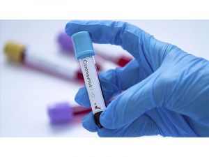О новых случаях выявления заболевания коронавирусом в Югре на 10 мая