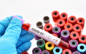 178 человек заболели коронавирусом в Югре за сутки, пять пациентов умерли